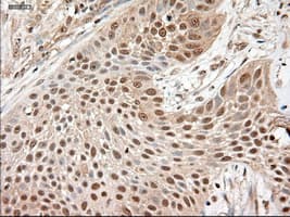 NTF3 / Neurotrophin 3 Antibody (clone OTI5C7)