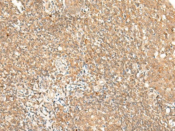 GPR89A Antibody