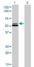 GSR / Glutathione Reductase Antibody (clone 6B4)