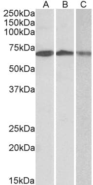 IHC-plus™ Polyclonal Goat anti-Human OAS2 Antibody (Internal Region, IHC, WB)