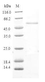 Human RNF125 / TRAC-1 Protein (Recombinant GST, N-terminus)