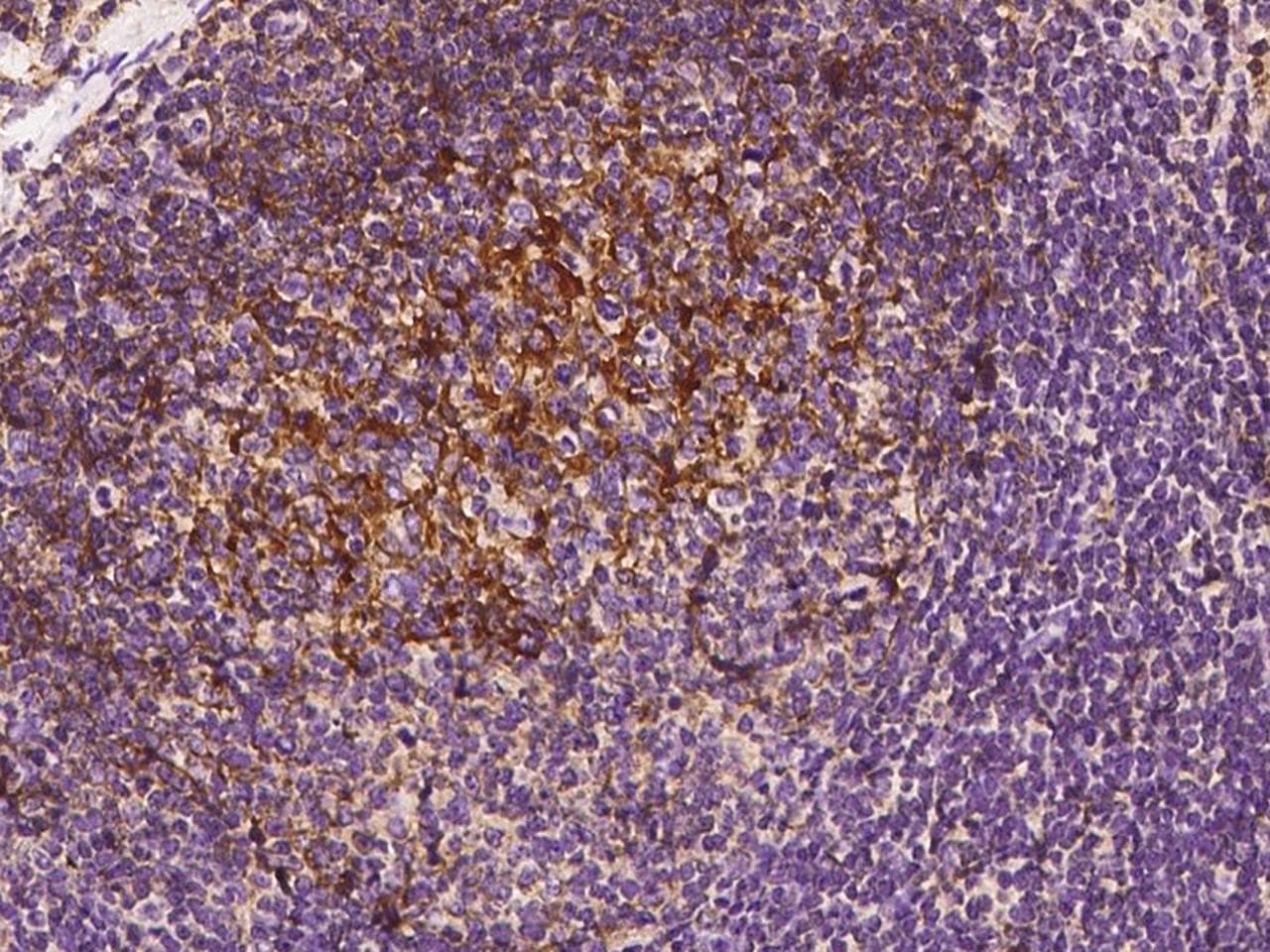 Polyclonal Rabbit anti-Human CR2 / CD21 Antibody (Preservative Free, IHC, WB)