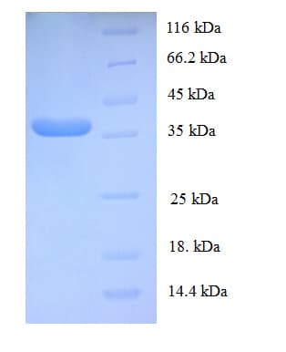 Human GTF2E2 Protein (Recombinant His)
