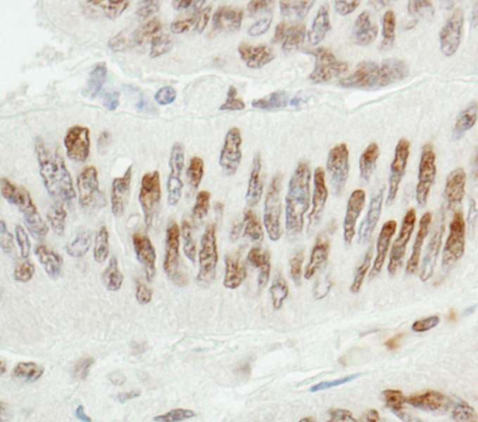 ZBTB7A / Pokemon Antibody (aa525-C-term)