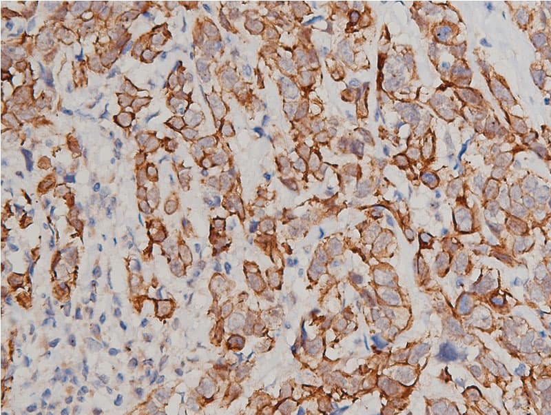 KRT8 / CK8 / Cytokeratin 8 Antibody (phospho-Ser432)