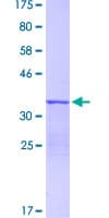 Human S100A12 Protein (Recombinant GST)