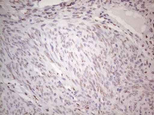TLK2 Antibody (aa1-296, clone OTI2D10)