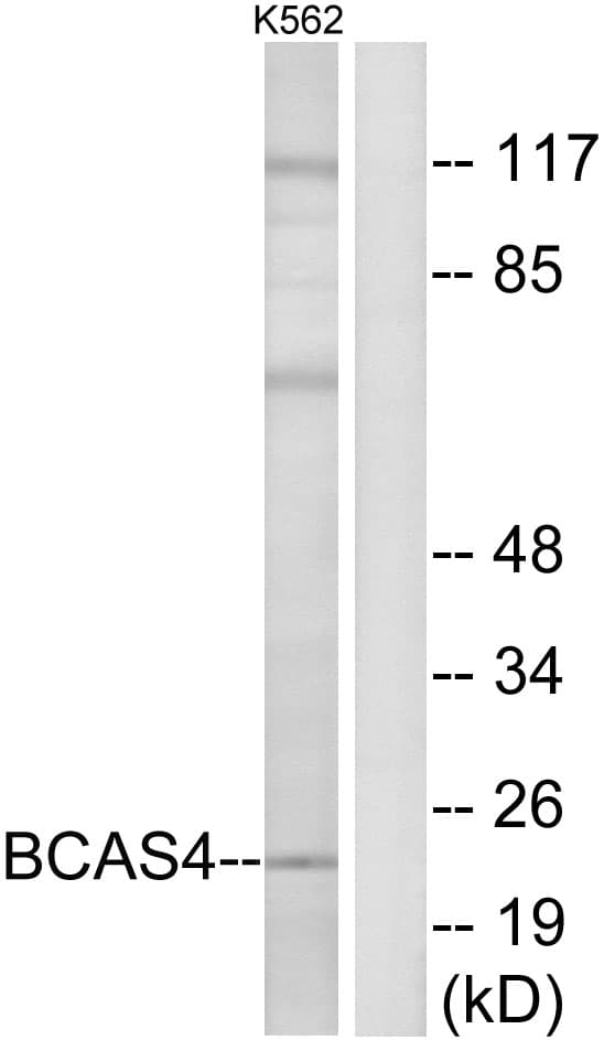 Polyclonal Rabbit anti-Human BCAS4 Antibody (aa31-80, IHC, WB)