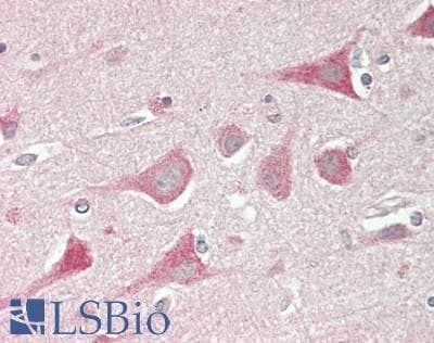 IHC-plus™ Polyclonal Rabbit anti-Human PFN2 / Profilin 2 Antibody (Internal, IHC, WB)