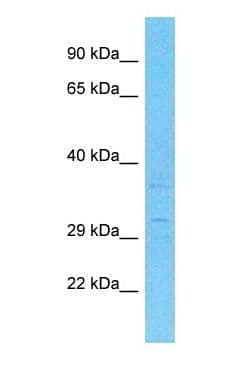 PARPBP / C12orf48 Antibody (C-Terminus, HRP)