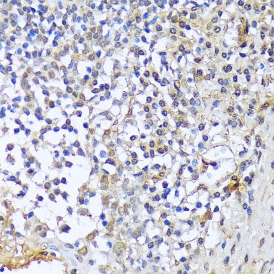 Polyclonal Rabbit anti-Human A1CF / ACF Antibody (IHC)