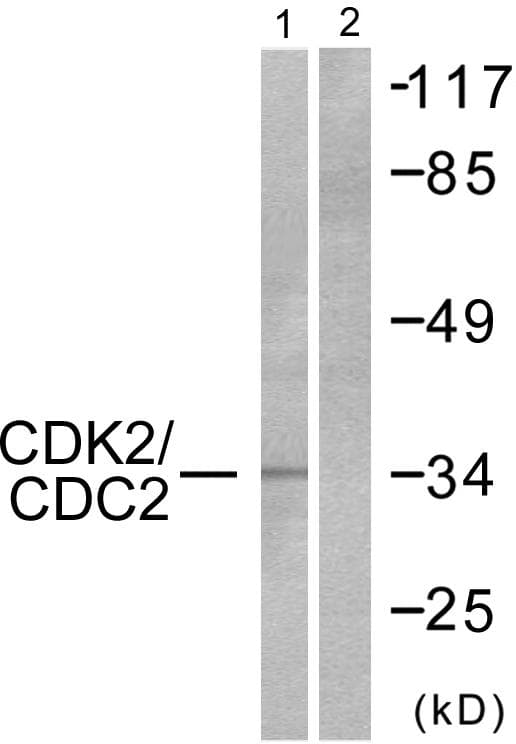 PTPN11 / SHP-2 / NS1 Antibody (p580)