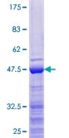 Human ZCCHC13 Protein (Recombinant GST)