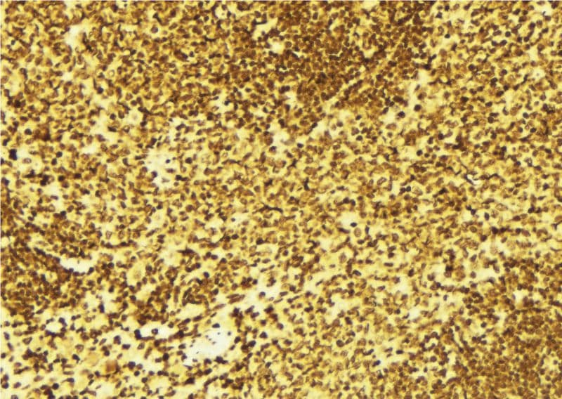 Polyclonal Rabbit anti-Human TP73 / p73 Antibody (IHC, WB)