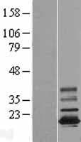 TMEM11 Protein (Over-Expression Lysate Myc-DDK (Flag))