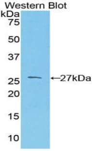 PRNP / PrP / Prion Antibody (aa23-230)