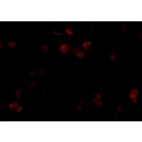 Polyclonal Rabbit anti-Human CD81 Antibody (IHC, IF, WB)