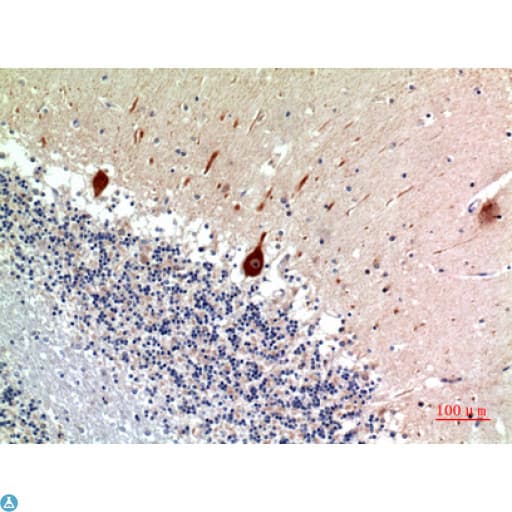 NODAL Antibody