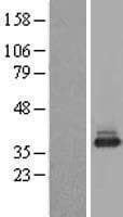 NACA Protein (Over-Expression Lysate Myc-DDK (Flag))