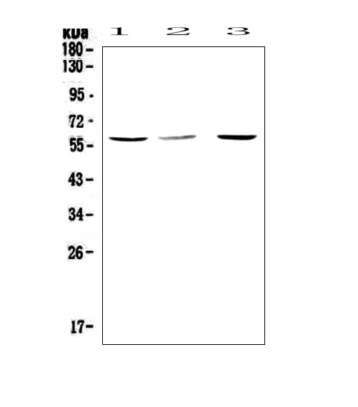 Polyclonal Rabbit anti-Human CASP8 / Caspase 8 Antibody (WB)