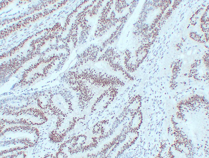 Monoclonal Mouse anti-Human MLH1 Antibody (clone ABT-MLH1, IHC, WB)
