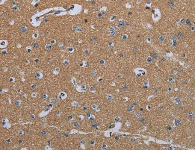 FAAH Antibody