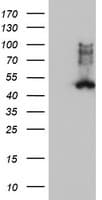 Monoclonal Mouse anti-Human FDFT1 / Squalene Synthase Antibody (clone OTI2F10, IHC, IF, WB)