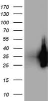 ARH / LDLRAP1 Antibody (clone OTI3H10)
