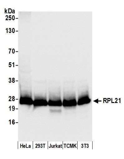 RPL21 / Ribosomal Protein L21 Antibody (aa110-160)