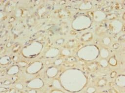 IHC-plus™ HBB / Hemoglobin Beta Antibody (aa1-147)
