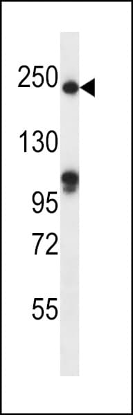 IHC-plus™ Polyclonal Rabbit anti-Human SLIT1 Antibody (aa84-113, IHC, WB)