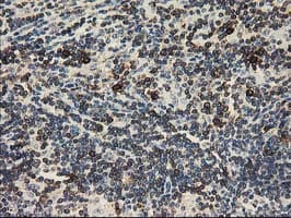 ERIC-1 / TACC3 Antibody (clone OTI8B7)