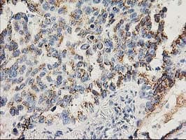 FGF21 Antibody (clone OTI1H4)