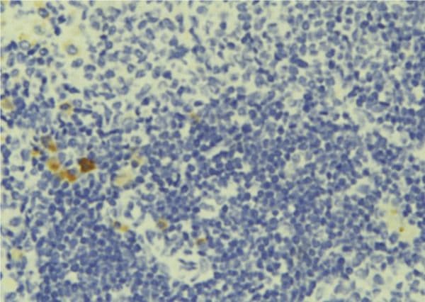 PCM1 Antibody