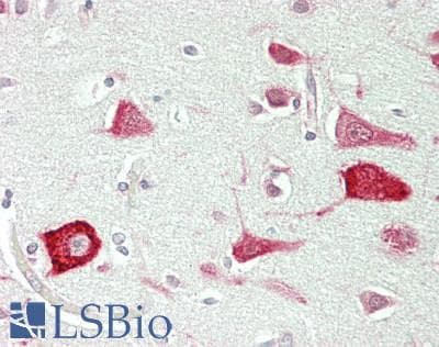 IHC-plus™ EF1G / EEF1G Antibody (aa400-C-term)