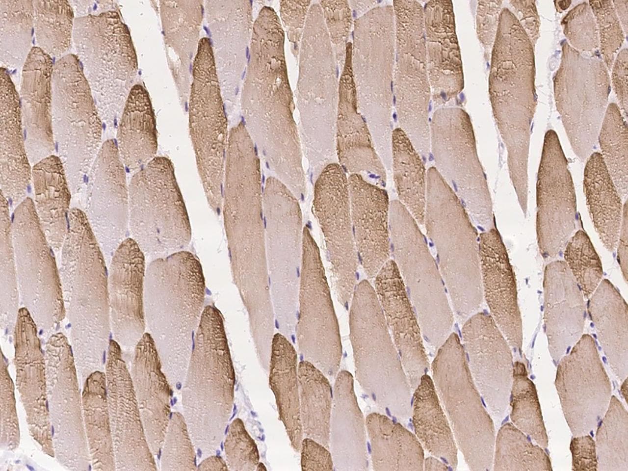PYGM Antibody