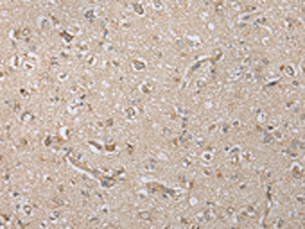 Polyclonal Rabbit anti-Human NDUFA12 / B17.2 Antibody (IHC, WB)