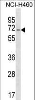 GPATCH4 Antibody (aa236-262)