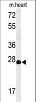 CLDN4 / Claudin 4 Antibody (aa171-197)