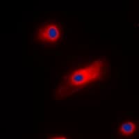 Polyclonal Rabbit anti-Human ARR3 / Cone Arrestin Antibody (C-Terminus, IHC, IF, WB)