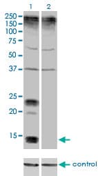 KCNE1 / MinK Antibody (clone 5B12)