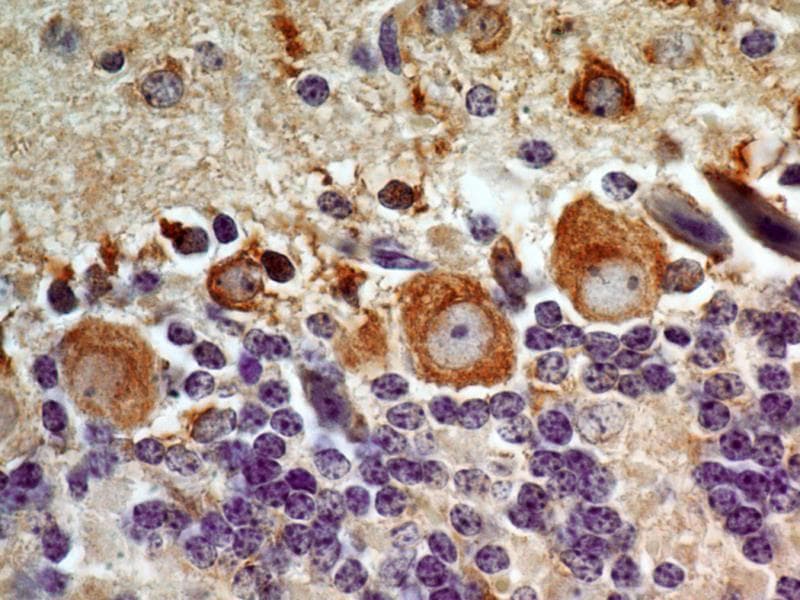LIF Antibody (aa24-203, clone 39N7D10)