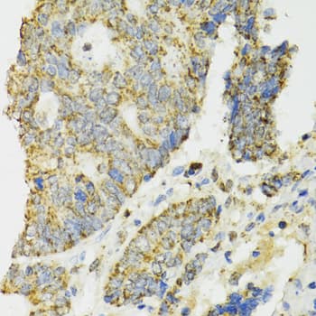Polyclonal Rabbit anti-Human IDH2 Antibody (IHC, IF, WB)