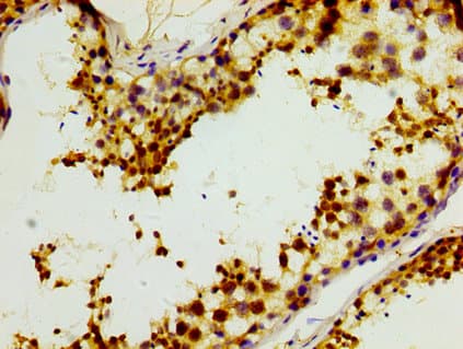 Polyclonal Rabbit anti-Human ABRI / ITM2B Antibody (IHC)