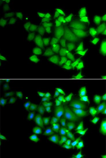 TET3 Antibody