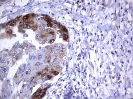 CD30 Antibody (clone OTI18D3)