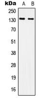 ITGAV/Integrin Alpha V/CD51 Antibody (Internal)