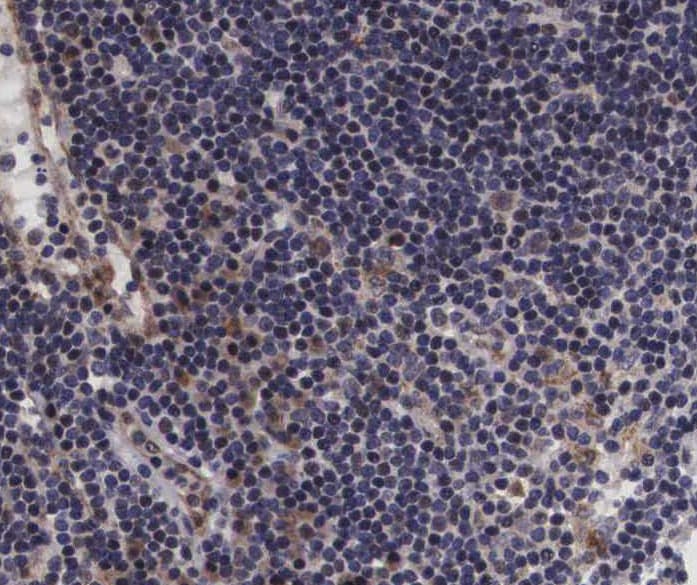 Polyclonal Rabbit anti-Human VAV1 / VAV Antibody (phospho-Tyr174, IHC, IF, WB)