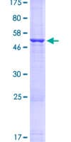 Human HLA-DQB1 Protein (Recombinant GST)