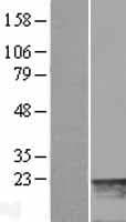 MYL7 Protein (Over-Expression Lysate Myc-DDK (Flag))